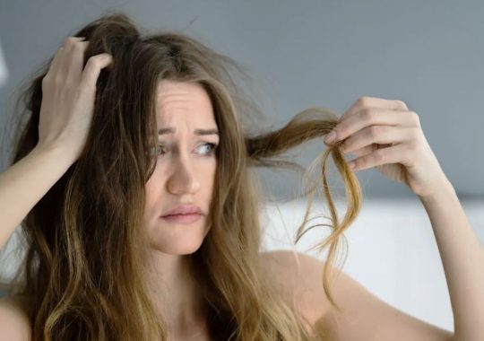 The Connection Between Hormones and Hair Loss