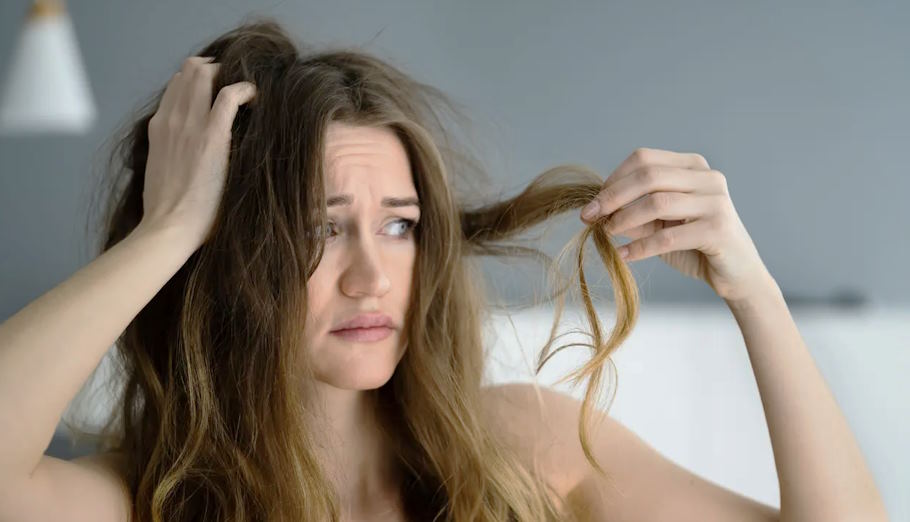 The Connection Between Hormones and Hair Loss